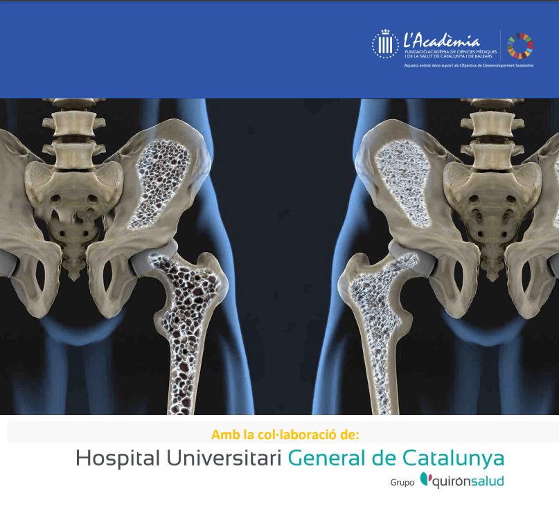 osteoporosi evento HUGC